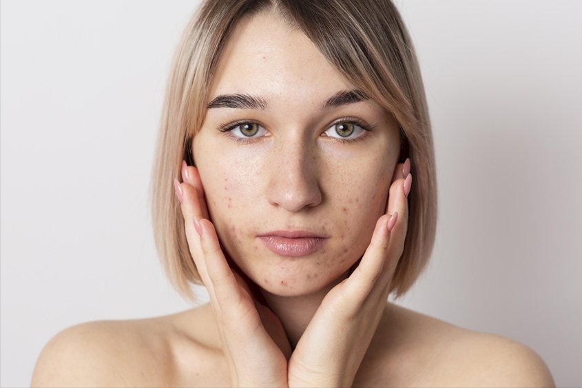 Understanding Skin Pigmentation and Effective Solutions to Tackle Pigmentation