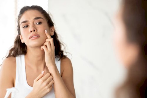 Let’s Have a Sneak Peek about Common Skin Problems & Ways to Solve Them