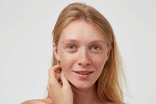 Treating Hyperpigmentation: A Vital Aspect of Skincare Awareness Month